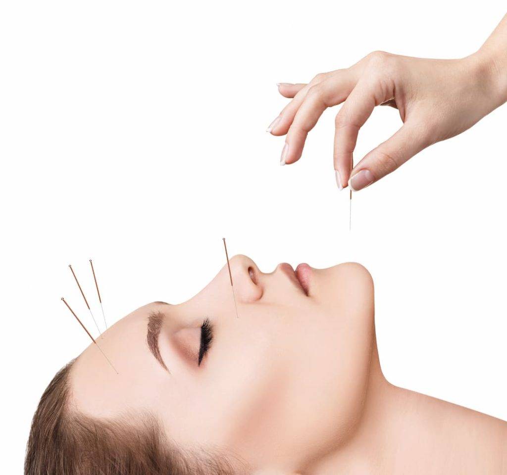 Person Administering Acupuncture Needles To A Womans Face